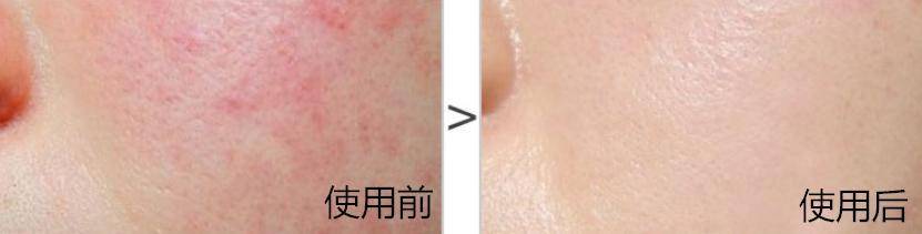 护肤国货片仔癀,护肤化妆品片仔癀