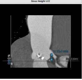 罗建方医生怎么样,罗建方教授