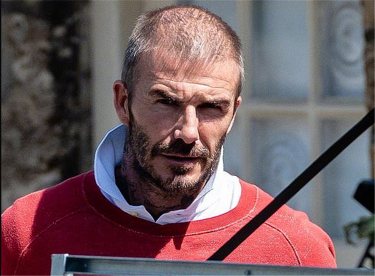 贝克汉姆头秃,贝克汉姆秃了头