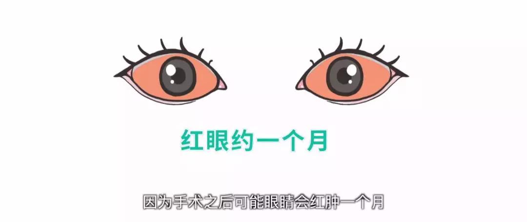 眼睛斜视和斜视检查有什么区别,斜视弱视可以做斜视手术吗