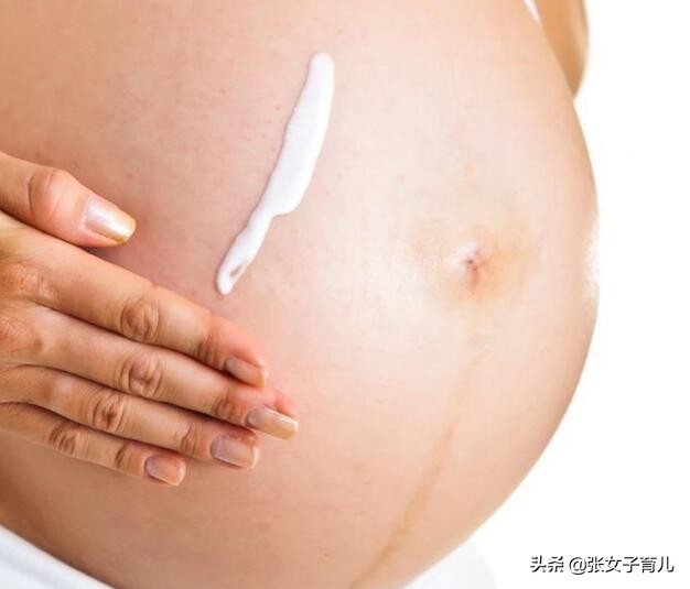 孕期擦油防止妊娠纹手法,孕期用什么护肤品可以减轻妊娠纹