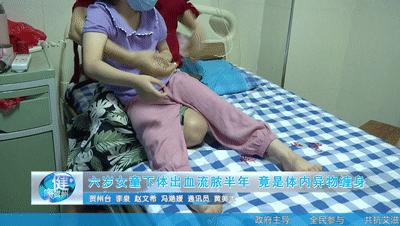 一岁女宝尿液中有鼻涕一样的粘液,6岁女儿体内发现异物