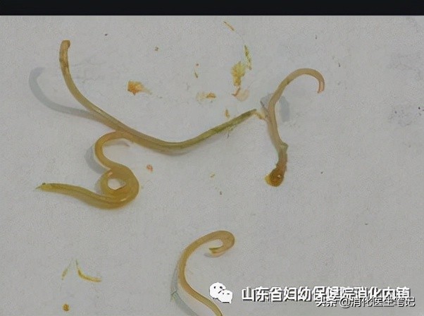 老年人肠胃镜检查,65岁老人胃肠镜检查