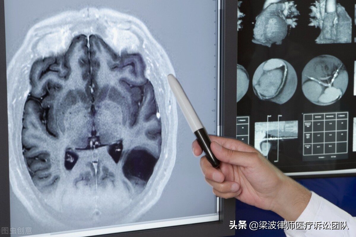 医疗纠纷误诊漏诊癌症,漏诊肿瘤医疗纠纷