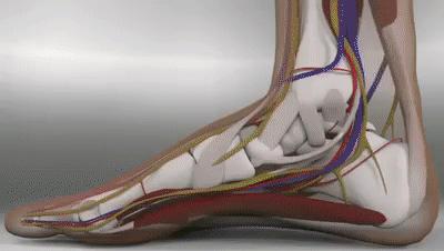 您重视过踝关节扭伤吗?扭伤3个月还不好,我们应该做点什么呢?
