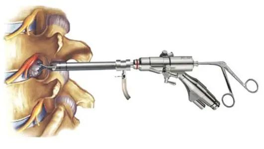 腰椎间盘突出，手术并非最好的治疗方法。中医正骨有说道