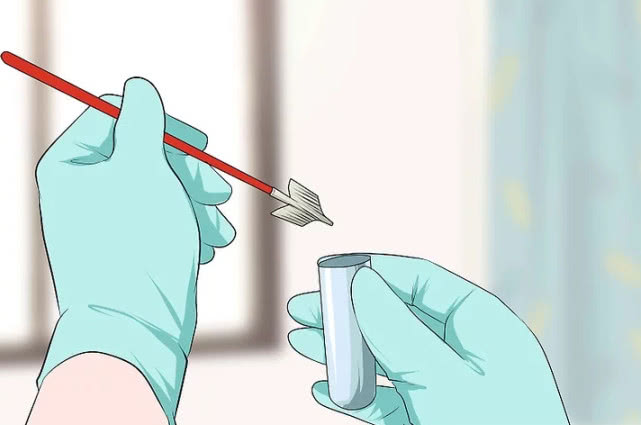 宫颈癌晚期吃什么药可以减轻痛苦,宫颈癌晚期患者痛苦时按哪个穴位