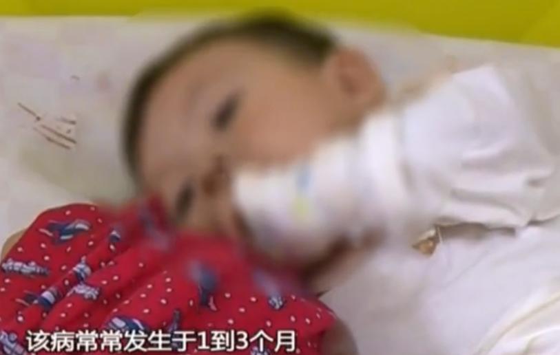 女婴出生50天脑出血,男婴出生月余突发脑出血