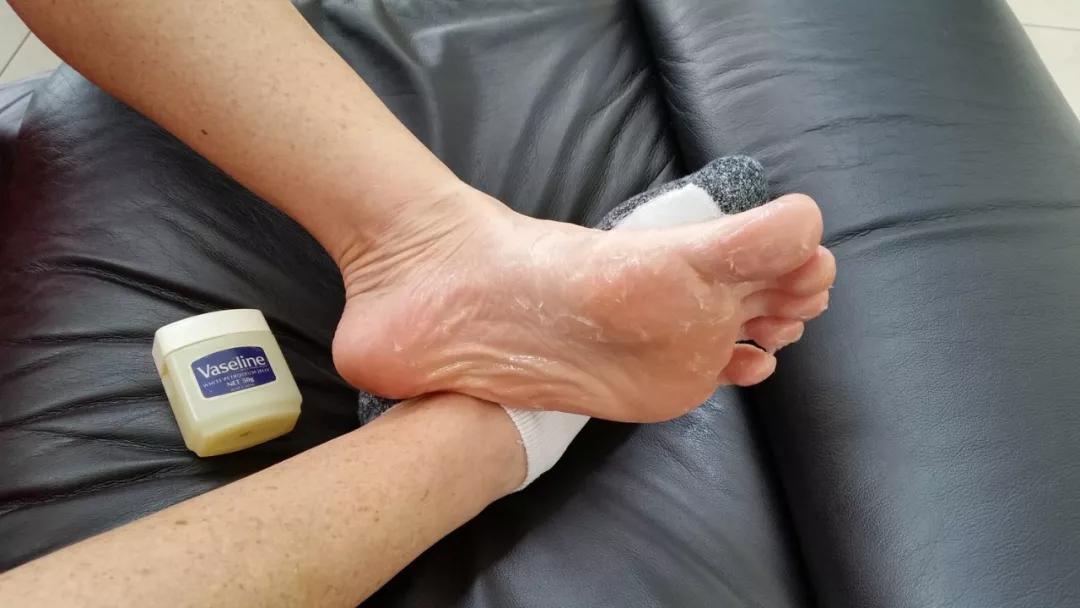 如何使足球鞋变得合脚,新足球鞋磨脚后跟处理4种方法