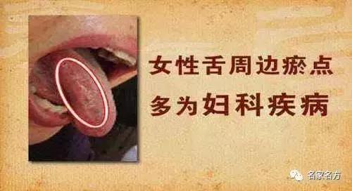 舌头是人体自带的体检表，一旦出现这个信号，马上去医院