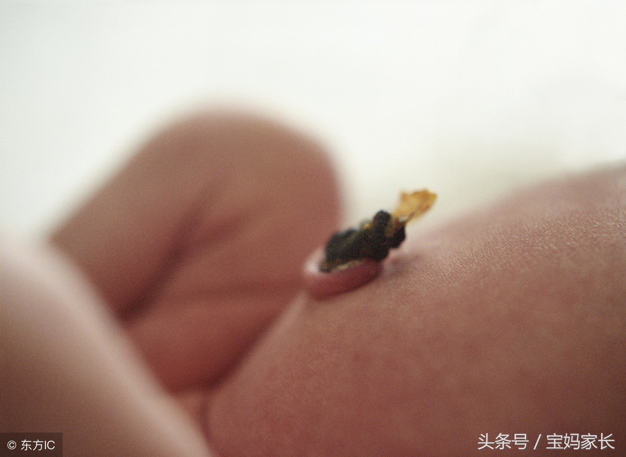 新生儿脐带不护理可以吗,胎儿剪断后的脐带自然脱落吗