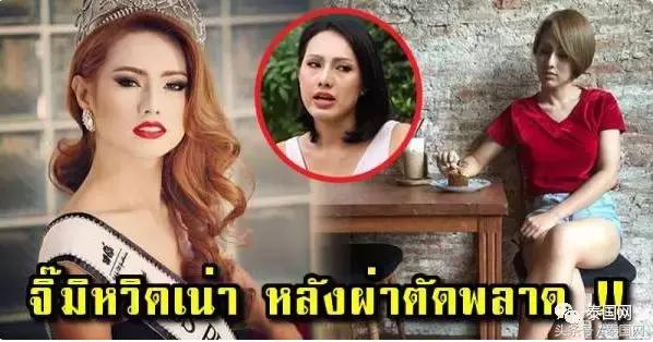 泰国整形变性手术,泰国变性整形手术