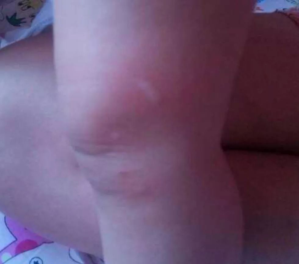 小孩突然全身发痒啥原因,孩子突然全身发痒怎么治病