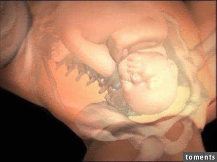 震撼分娩瞬间,分娩过程震撼