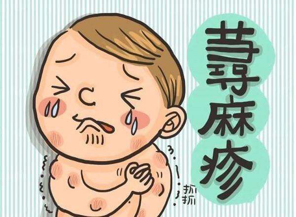 荨麻疹皮肤发红灼热刺痛,荨麻疹奇痒难忍需要打点滴吗