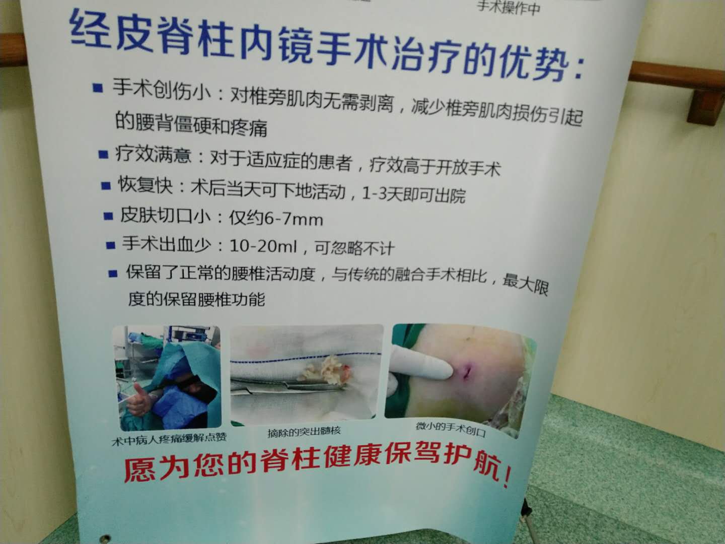 什么叫微创脊柱内镜手术,全可视脊柱内镜技术