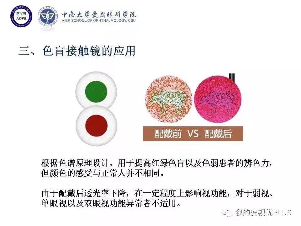 色弱色盲矫正隐形眼镜带度数的,爱尔眼科矫正视力隐形眼镜