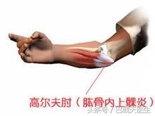 肘关节疼痛一招解决,肘关节疼痛吃什么药物