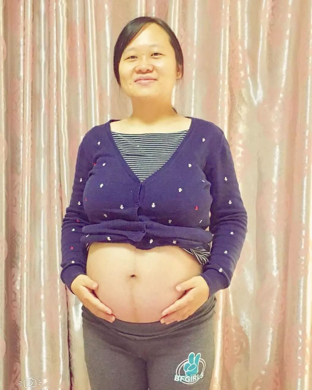 紫癜性肾炎的亲身经历,肾炎妈妈的真实故事