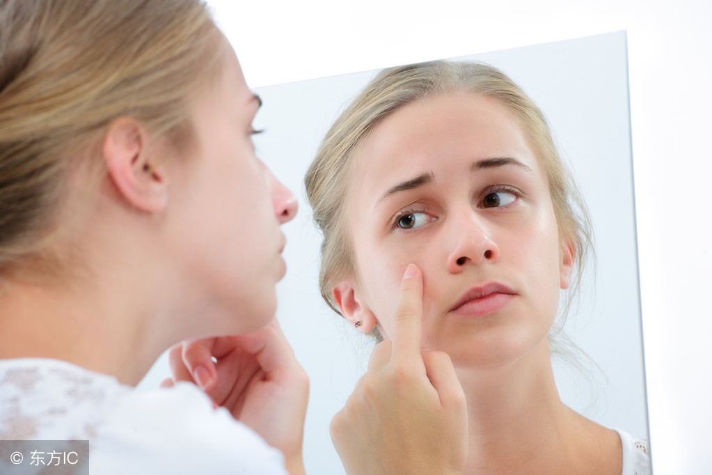 暗疮的症状的照片,暗疮的症状是什么样子的