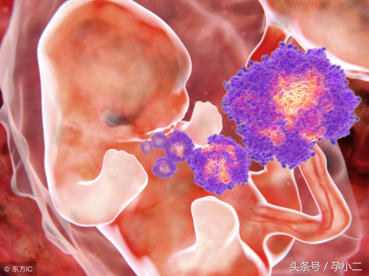 孕妇维生素过量会导致胎儿畸形吗,孕期维生素补充多了会不会长痘