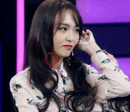 明星脖子上的“小草莓”太抢镜，赵薇甚至多次都能被拍到吻痕？