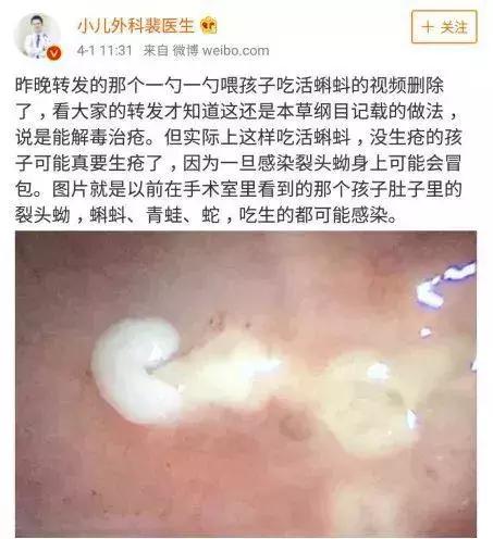 给孩子喂食活蝌蚪,孩子能吃活的蝌蚪吗