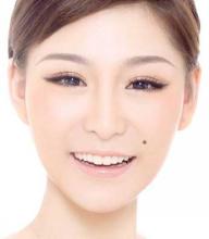 不同的的痣都代表什么,不同位置的痣的面相