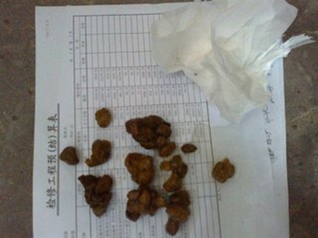 如何判断宝宝大便是否正常,怎么判断宝宝大便是否正确