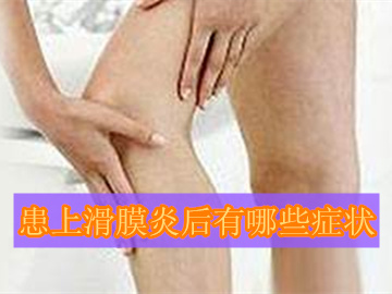 滑膜炎出现的症状,得了滑膜炎是什么症状