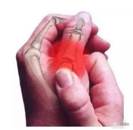 鼠标手指酸痛的治疗方法,鼠标手酸痛难受怎么办