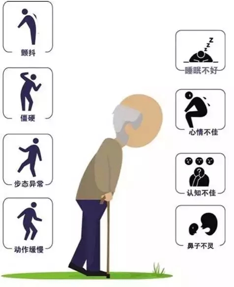 帕金森病不一定手抖,帕金森不止手抖这么简单一文自测