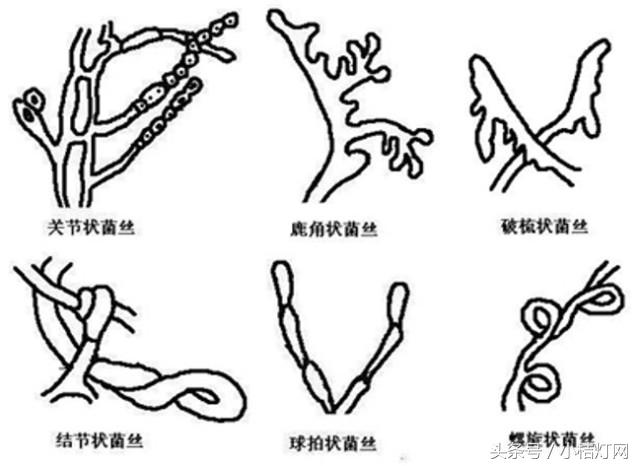真菌微生物国标检测方法,微生物真菌检验