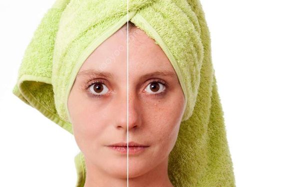 孕期的妊娠斑还有救吗,孕期妊娠斑能下去吗