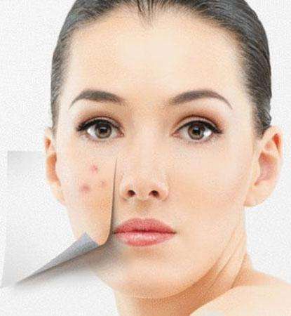 为什么月经前有姨妈痘,每次月经前下巴长红肿硬痘痘