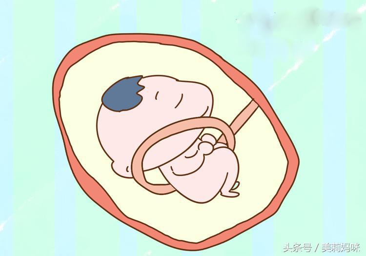 孕晚期宝宝会脐带绕颈吗,孕晚期胎儿脐带绕颈一圈怎么纠正