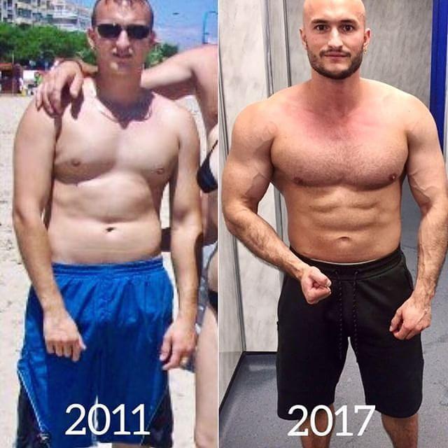 减肥后皮肤松弛靠运动可以紧致吗,胖子减肥后肚子皮肤松弛如何消除