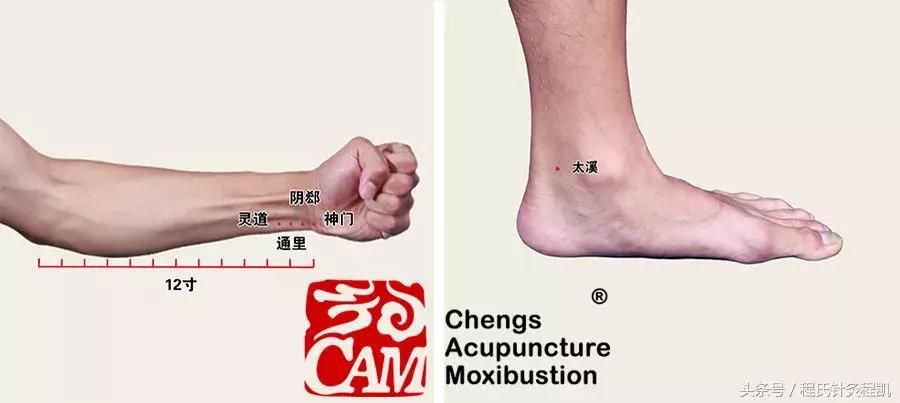程凯养生说血瘀按什么穴位,程凯养生说血瘀治疗方法