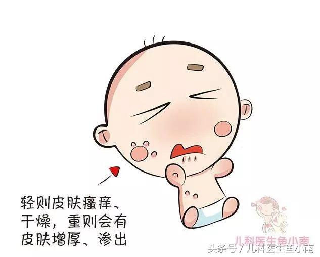 孩子湿疹反复记住这三招,宝宝湿疹反反复复的怎么办