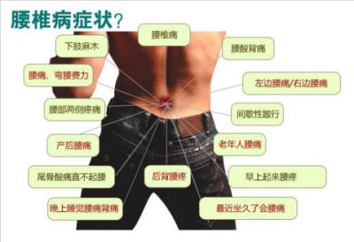 忍一忍就好了？腰突危害不是想的那么简单重在养成健康生活习惯