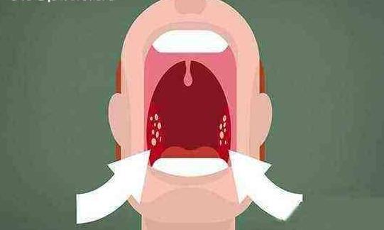 女子结婚恶心呕吐,为什么结婚后都口臭