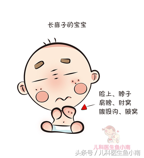 湿疹热疹傻傻分不清楚,为什么宝宝湿疹热疹反反复复