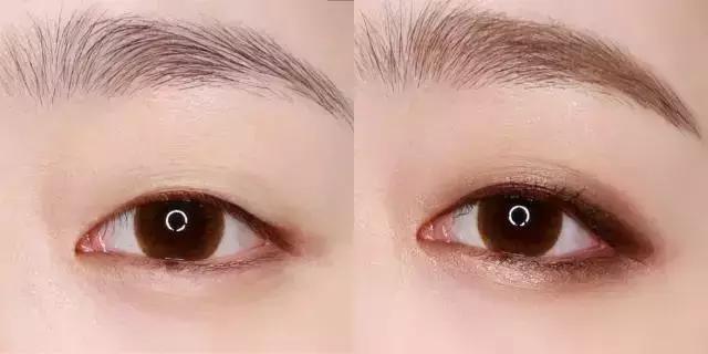 单眼皮肿眼泡无神怎么办,单眼皮肿眼泡眼妆怎么化