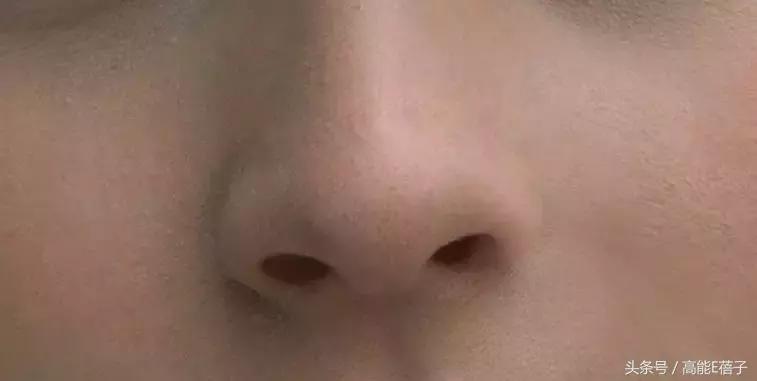 别傻了！蔡徐坤、Angelababy都根治不掉的黑头，微商神器能去除？