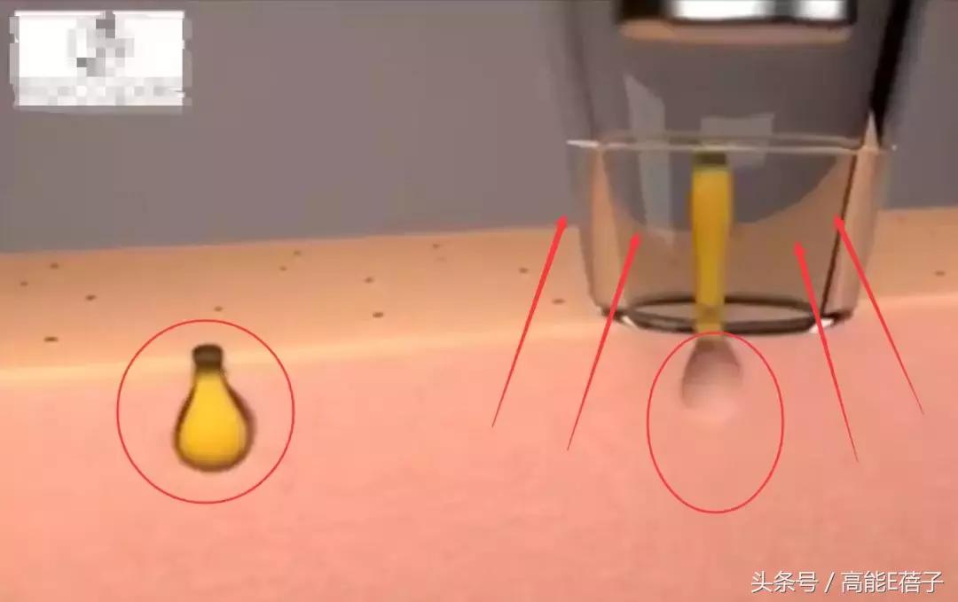 蔡徐坤、Angelababy都根治不掉的黑头，微商神器能去除？