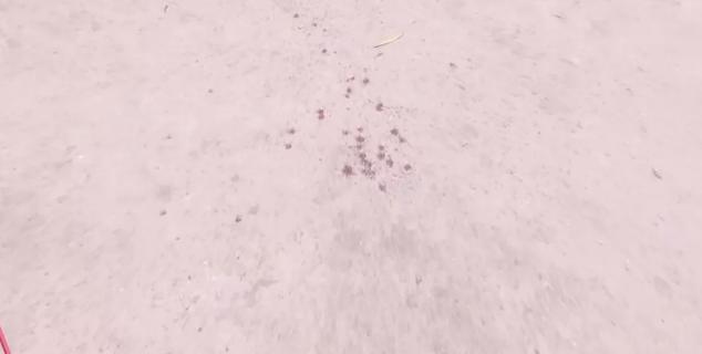 煤气灶爆炸烧伤男子,燃气灶爆炸烧伤男子