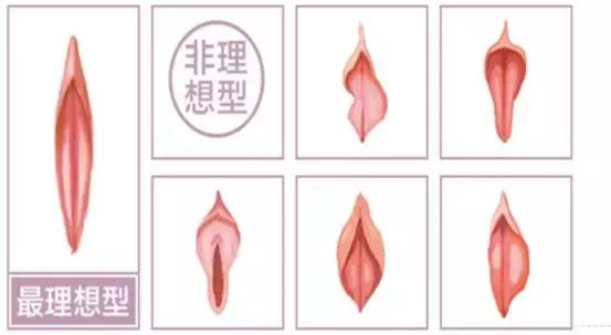 最危险的整容手术是隆胸吗,整容手术隆胸真实案例