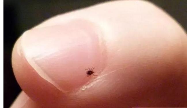 带小孩去草地玩怎么预防蜱虫,带孩子玩小虫子