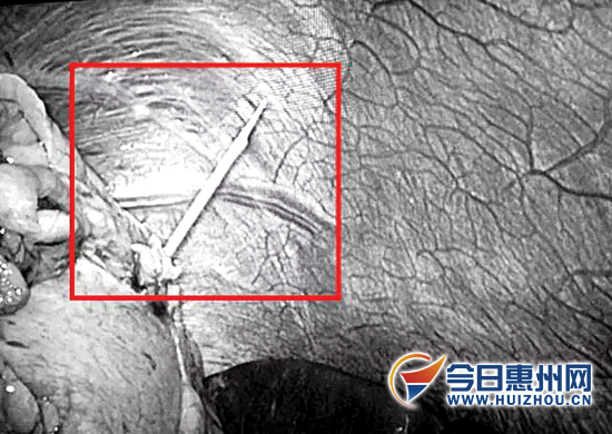 <html>
<head><title>502BadGateway</title></head>
<body>
<center><h1>502BadGateway</h1></center>
<hr><center>nginx</center>
</body>
</html>
<!--apaddingtodisableMSIEandChromefriendlyerrorpage-->
<!--apaddingtodisableMSIEandChromefriendlyerrorpage-->
<!--apaddingtodisableMSIEandChromefriendlyerrorpage-->
<!--apaddingtodisableMSIEandChromefriendlyerrorpage-->
<!--apaddingtodisableMSIEandChromefriendlyerrorpage-->
<!--apaddingtodisableMSIEandChromefriendlyerrorpage-->