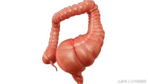 先天性巨结肠：越治越坏的腹泻患儿6个月内死亡率高达50%-70%